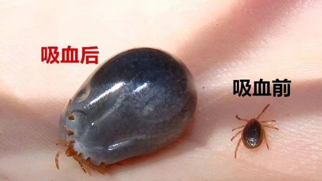 4岁孩子被蜱虫咬伤妈妈一个果断处理被医生称赞：做得好(图10)