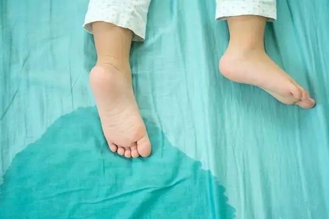 幼儿园老师最怕的5种穿搭孩子穿着也存在隐患家长可别踩雷了(图5)