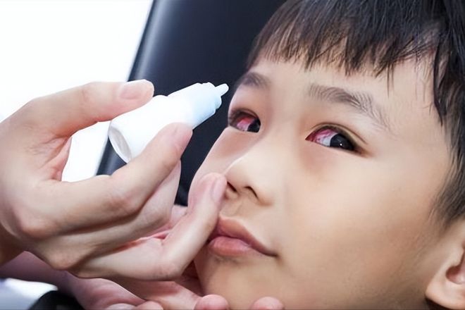 带孩子出趟门回来满身包！最近少穿这颜色的衣服出门太招虫子(图3)